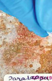 Recovered Covid patients may be immune to new virus strains Recovered Covid patients may be immune to new virus strains